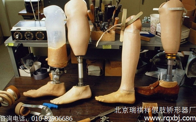 小腿假肢接受腔的選擇與種類(lèi) 假肢與矯形器指南