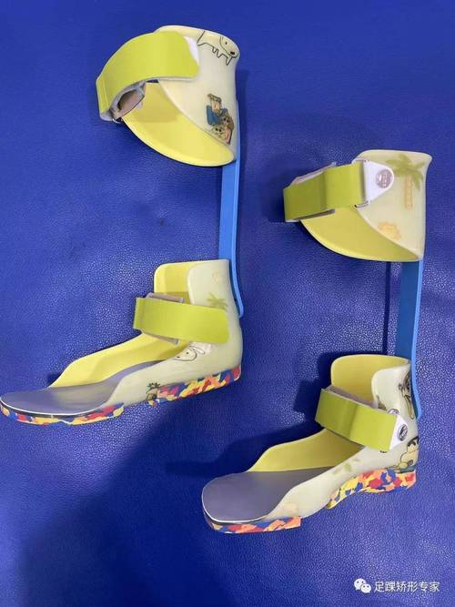 dmd/sma患兒的康復(fù)輔具系列產(chǎn)品介紹:包含矯正鞋,矯形器,定制輪椅和
