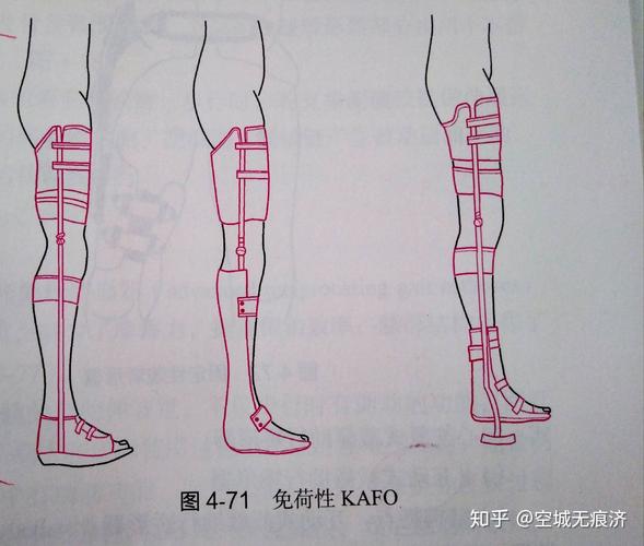 臨床康復(fù)工程學(xué)假肢與矯形器24&bull;